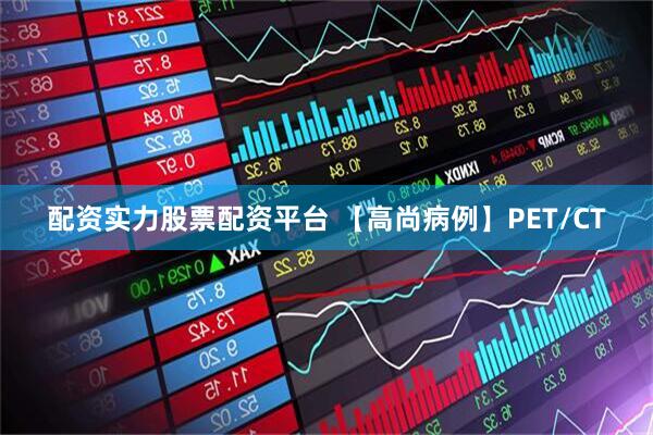 配资实力股票配资平台 【高尚病例】PET/CT